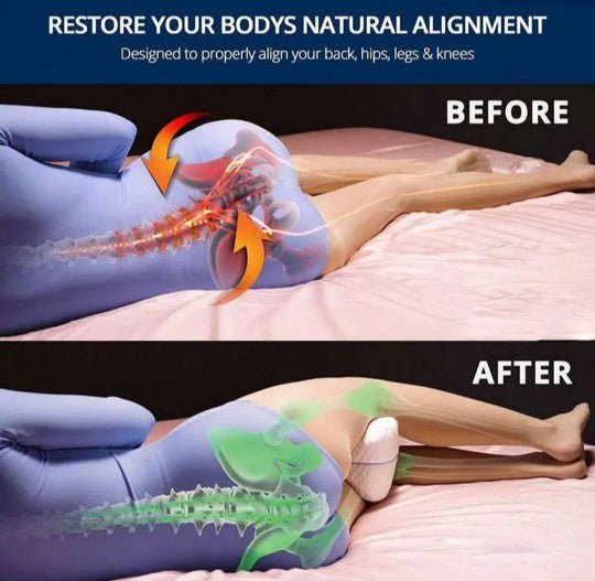 Leg pillow supporting spine alignment